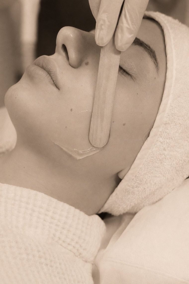 Sofwave treatment preparation