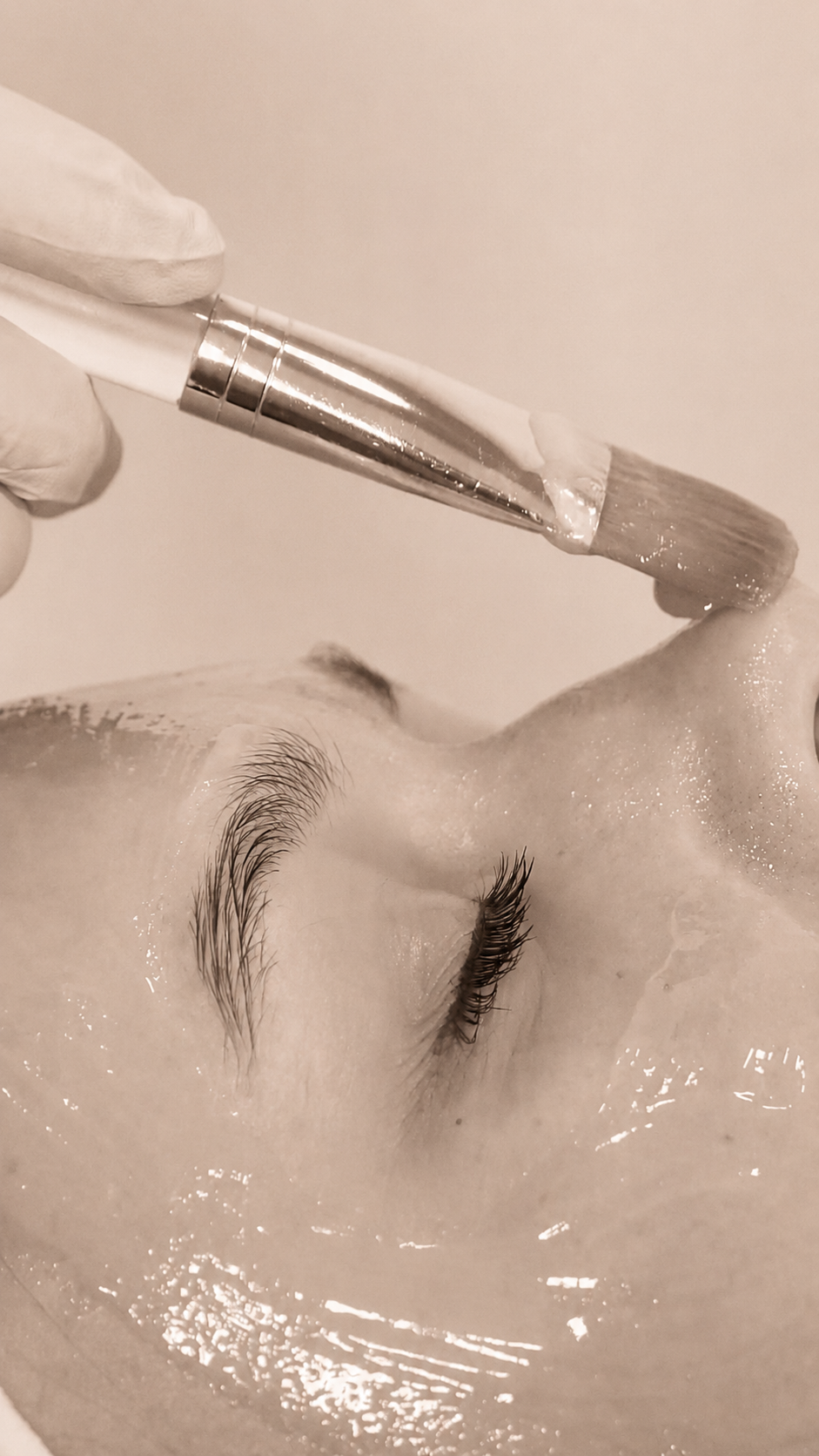 Chemical peel close-up detail