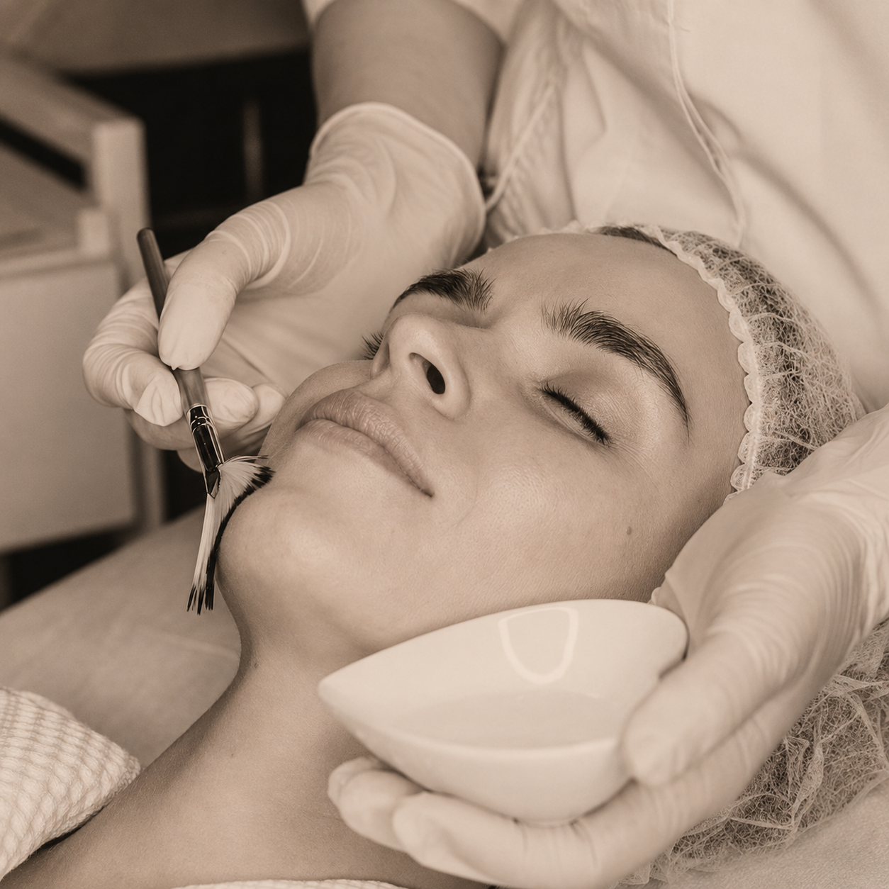 Chemical peel application in session