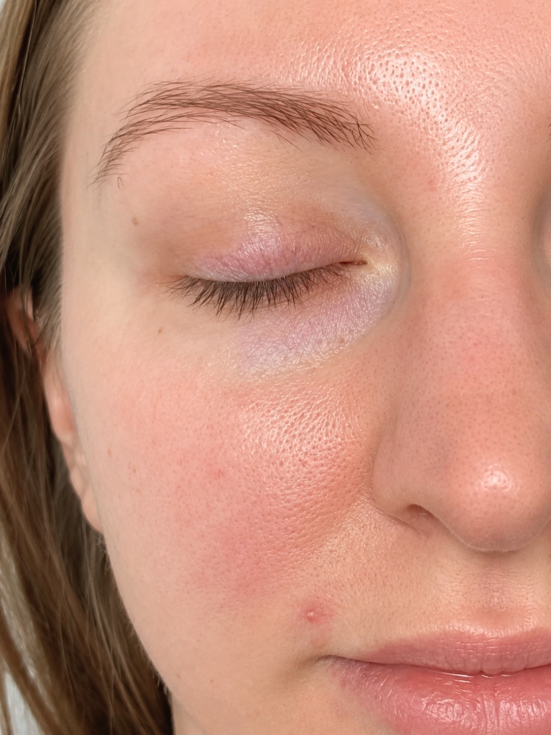 Sensitive skin before