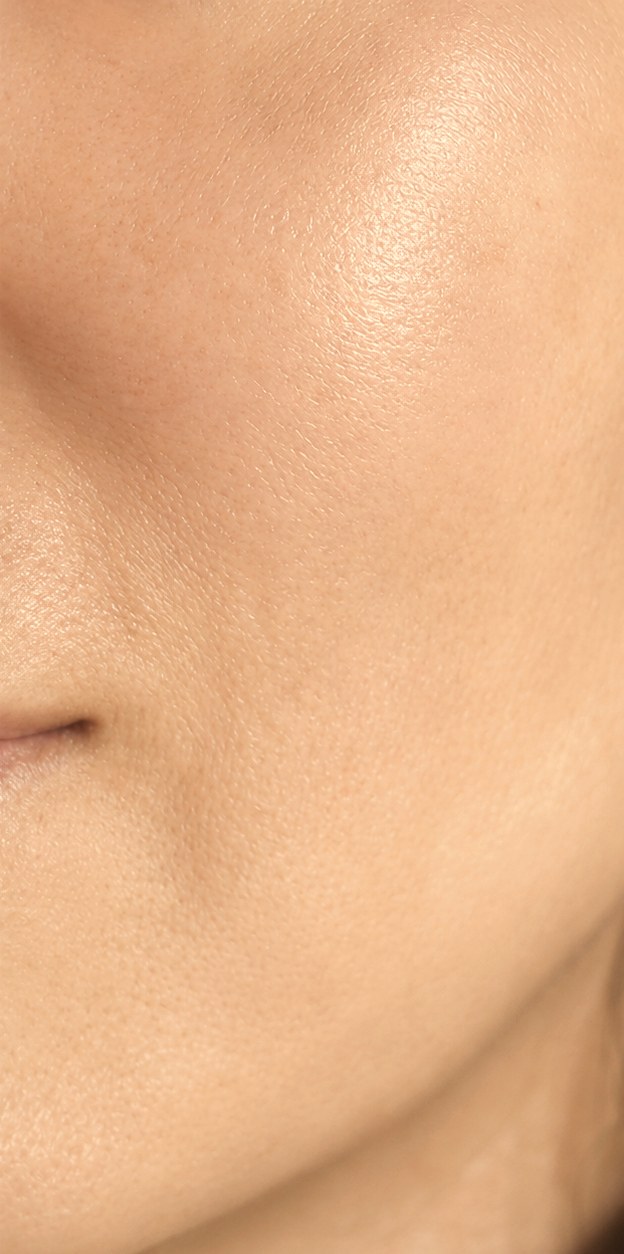 Pigmentation after