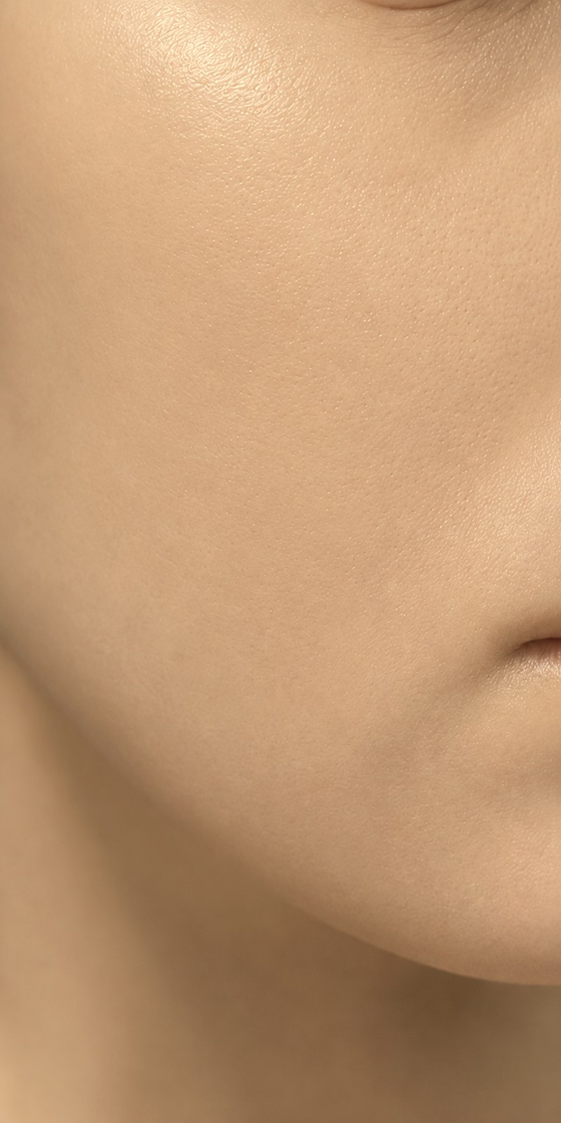 Post-acne scars after
