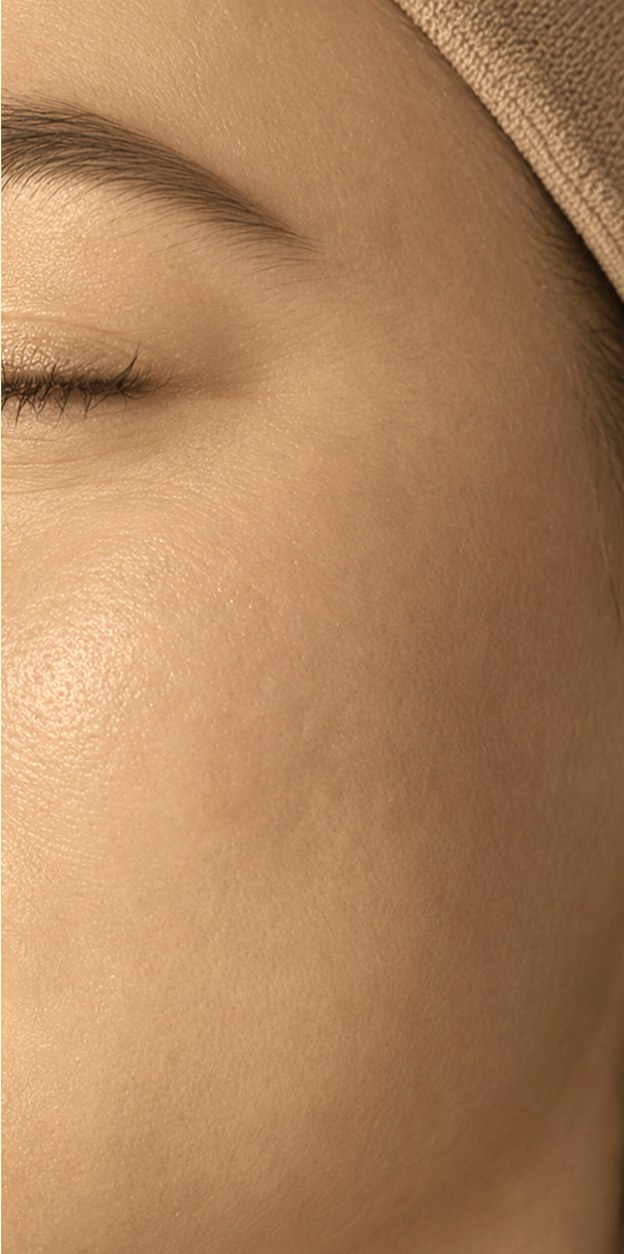 Uneven skin tone after
