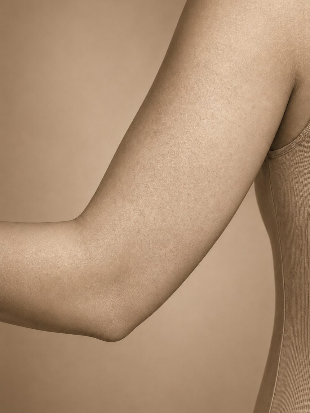 Uneven body texture - before
