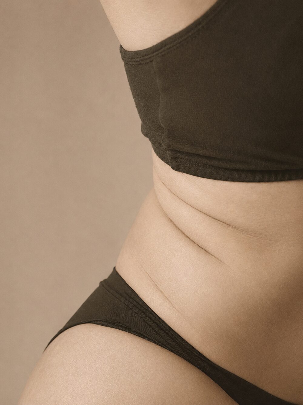 Localized fat - before