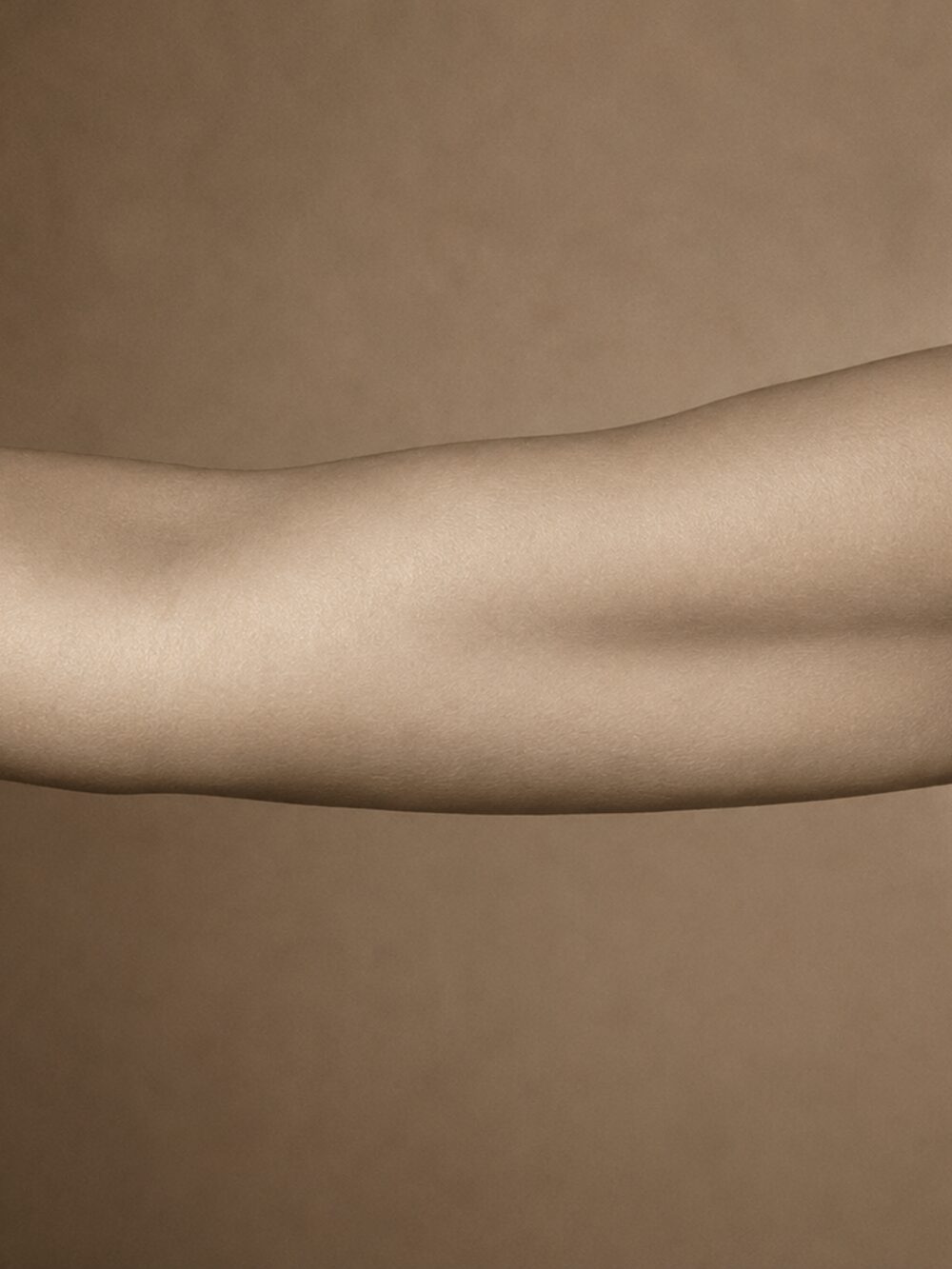 Body skin laxity - after