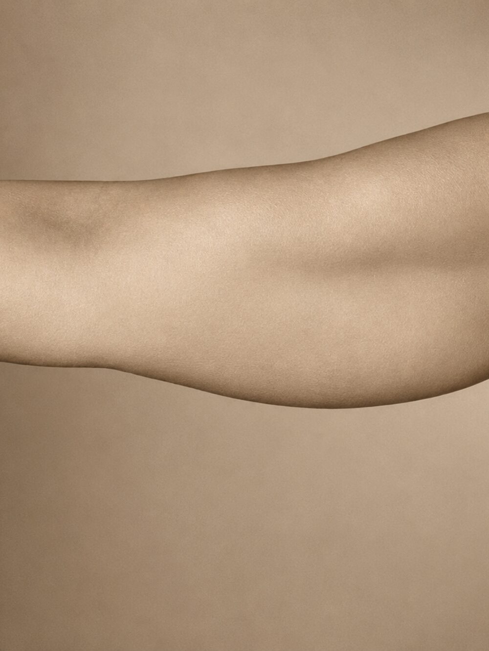 Body skin laxity - before